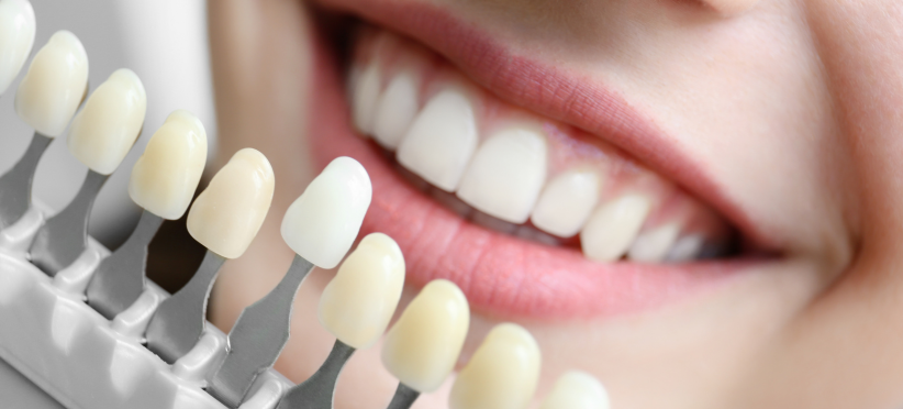 Estética dental